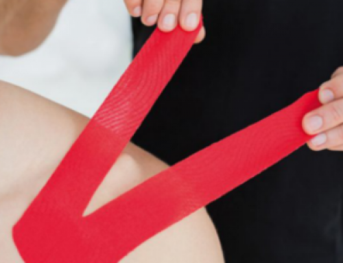 Applicazione taping neuro muscolare